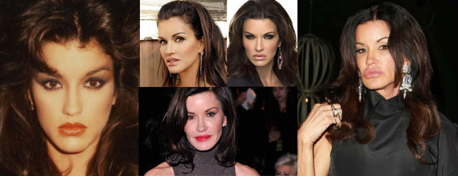 More related model janice dickinson plastic surgery.